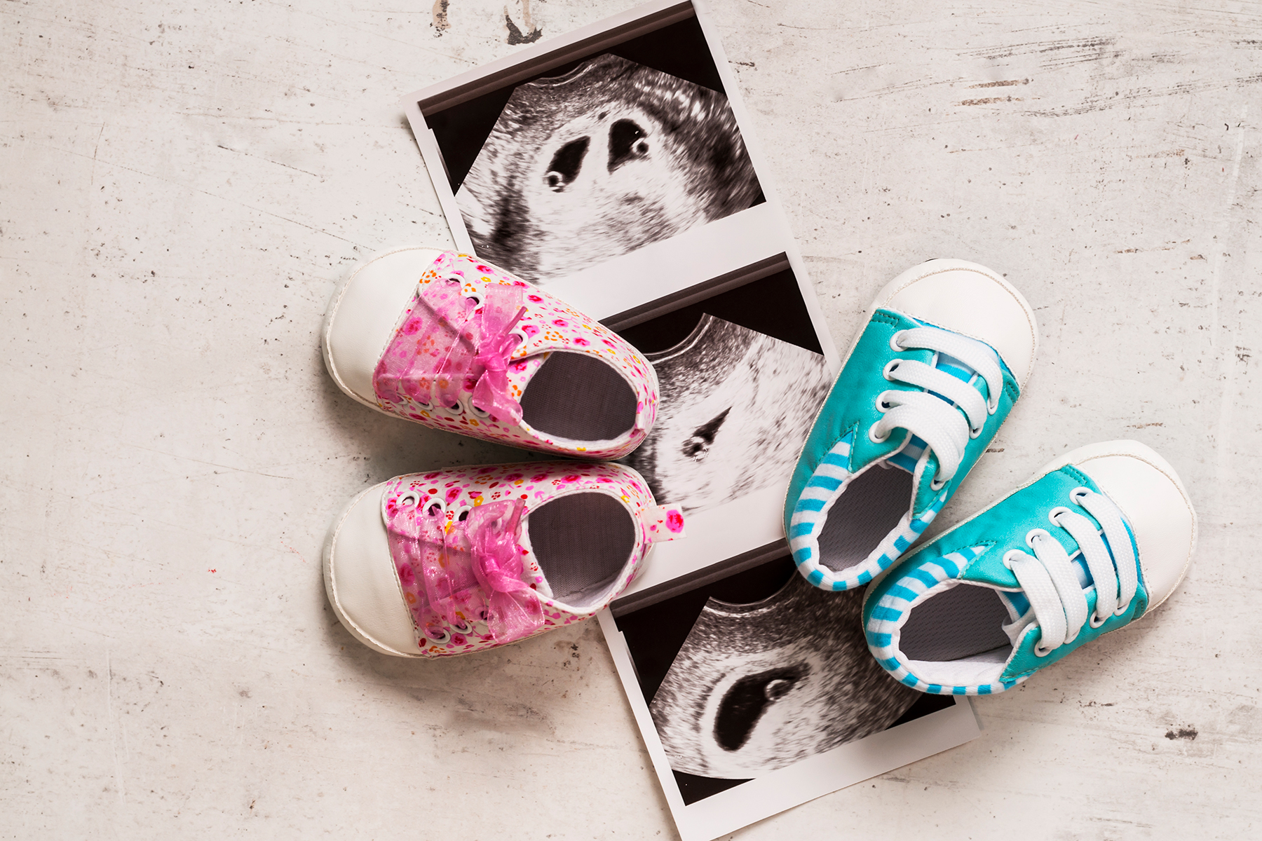 A photo of twin pregnancy scan with pink baby boots and blue baby boots on a marble background.
